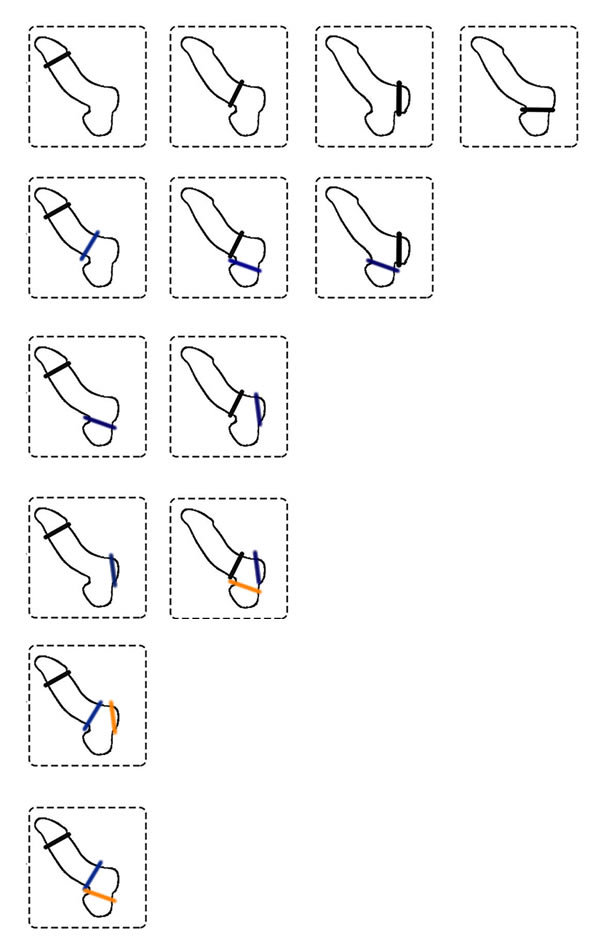 Kako namestimo enega ali več erekcijskih obročkov